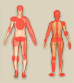 Click her eto see the interactive Aches & Pains Diagram